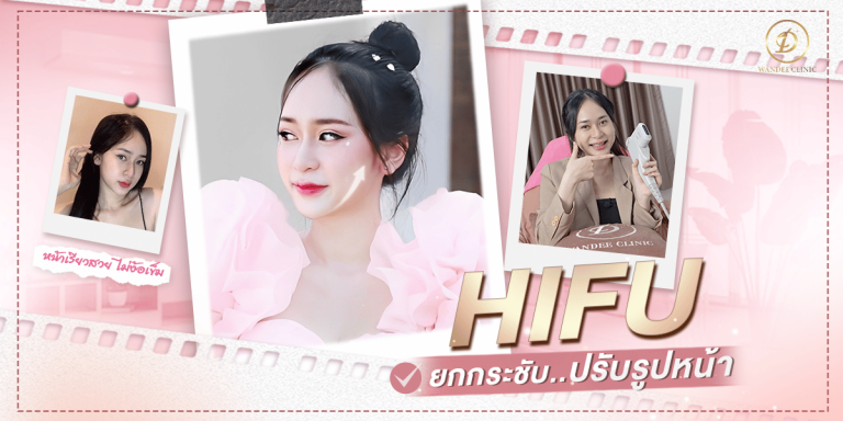รีวิว HIFU โปรแกรมหน้าเรียวยกกระชับ ฉบับไม่ง้อเข็ม จากคุณสายป่าน