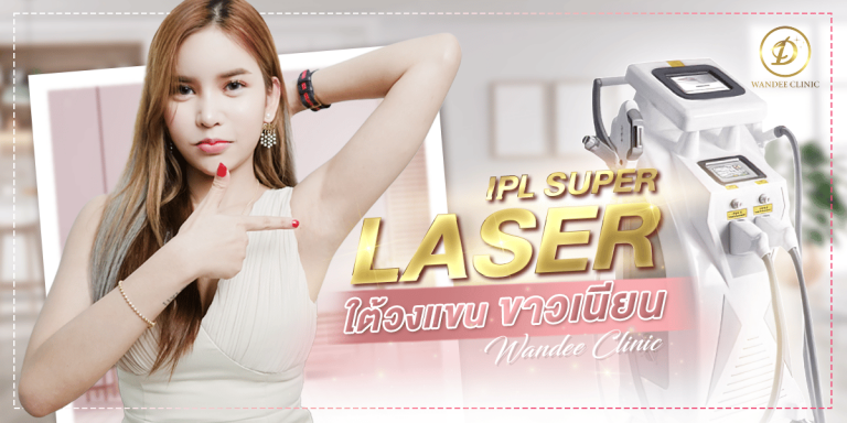 IPL Super Laser ขน จากคุณมิว เลเซอร์ขนใต้วงแขนให้ขาวเนียนสวย
