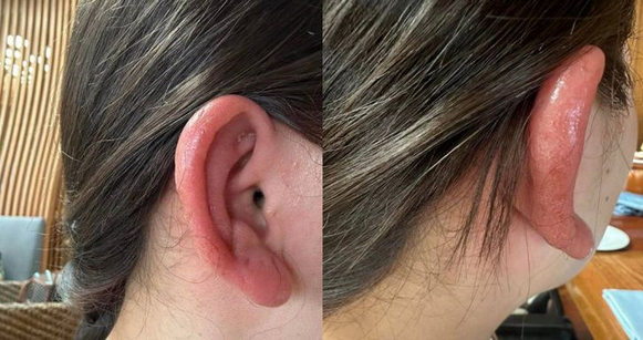 Screenshot 2025-08-02 at 08-46-19 เตือน! ต่างหู ที่ขช่แค่แพ้ แต่อาจถึงขั้นมะเร็ง