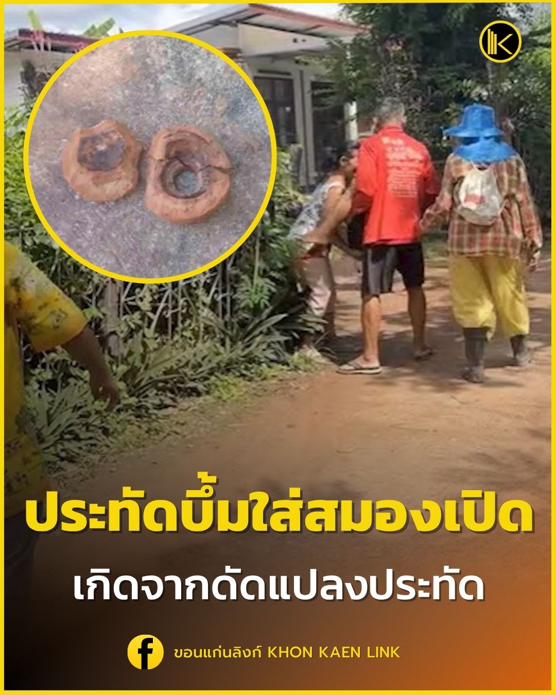 Poster ประกาศ