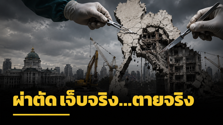 ผ่าตัด เจ็บจริง…ตายจริง…..